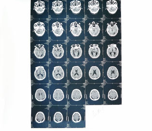 Ιατρική διαγνωστική απεικόνιση ακτίνας X εκτυπωτών λέιζερ εγγράφου για το νοσοκομείο