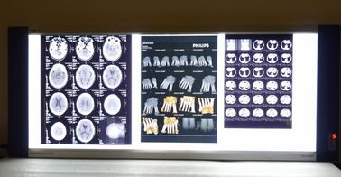ταινίες απεικόνισης 10in * 14in ψηφιακές των ακτίνων X ξηρές ιατρικές για τους θερμικούς εκτυπωτές knd-φ