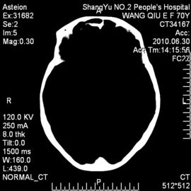 Good price 10 X 14 ευαίσθητος θερμικός ταινιών απεικόνισης ακτίνας X ιατρικός ξηρός για τον εκτυπωτή του Φούτζι σε απευθείας σύνδεση
