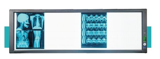 Καλή τιμή Υπεραναλαμπρό φακό LED για ιατρικές ανάγκες σε απευθείας σύνδεση