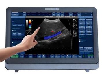 Good price Ιατρικό τρισδιάστατο/σύστημα υπερήχου Doppler χρώματος 4D φορητό με το όργανο ελέγχου 15 οδηγήσεων ίντσας σε απευθείας σύνδεση