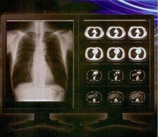 Φωτεινή σαφής ψηφιακή ταινία ακτίνας X, ιατρική ταινία διαφάνειας λέιζερ Konida