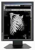 Good price 850cd/m2 επιδείξεις 20,1» μέγεθος G51SP ιατρικού βαθμού φωτεινότητας τύπων σε απευθείας σύνδεση