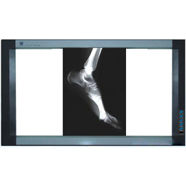 Ολογραφική ιατρική ταινία απεικόνισης, ταινία ακτίνας X της PET θερμικών εκτυπωτών