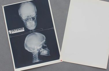 Διασπάσιμη άσπρη βάσεων ιατρική ταινία εγγράφου ακτίνας X της PET υλική