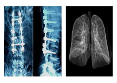 Αιχμηρές ακτινογραφικές ιατρικές ταινίες ακτίνας X, Mri ο Δρ Ct Digital Dry Imaging ταινία
