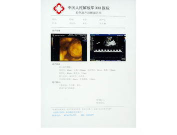 Γρατσουνιά-ανθεκτική ιατρική ταινία εγγράφου ακτίνας X για knd-drytec-3000, knd-drytec-4000