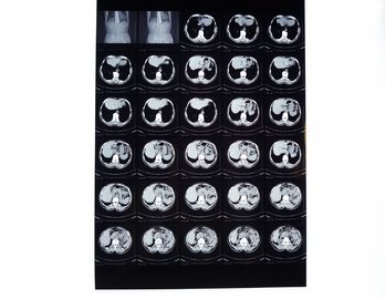 Good price Ξηρά ταινία ακτίνας X Drypix 2000 8 X 10 ίντσα Scrach ανθεκτικό για το Φούτζι 3000 σε απευθείας σύνδεση