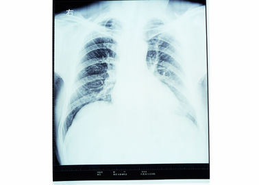 Ολογραφική ιατρική ταινία απεικόνισης, ταινία ακτίνας X της PET θερμικών εκτυπωτών