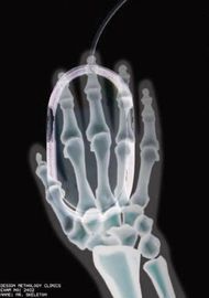 Ξηρά ιατρική ταινία απεικόνισης διαφάνειας, θερμική ψηφιακή ταινία ακτίνας X Agfa