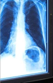 Μπλε ταινία 11in X 17in απεικόνισης ακτίνας X ξηρά ιατρική για το θερμικό εκτυπωτή